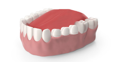 orthosquare crown and Bridges