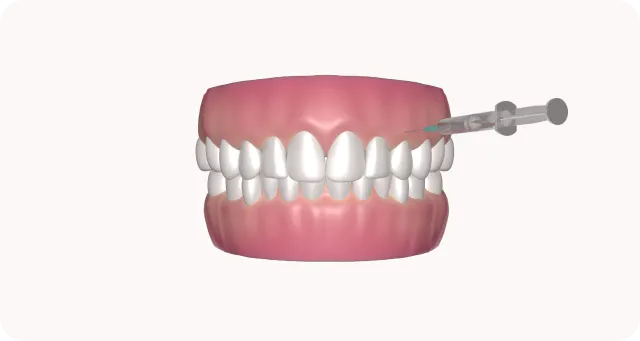 orthosquare tooth extraction