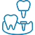 orthosquare crown and Bridges