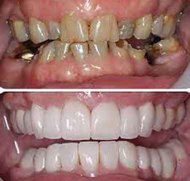 orthosquare root canal