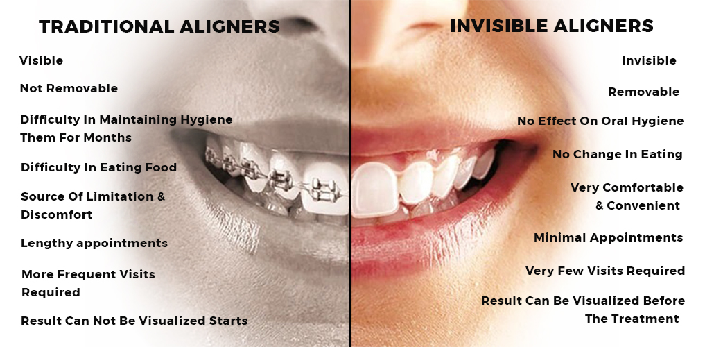 orthosquare invisible aligners